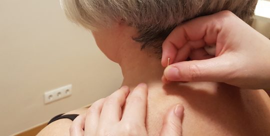 Tratamiento de acupuntura para la espalda